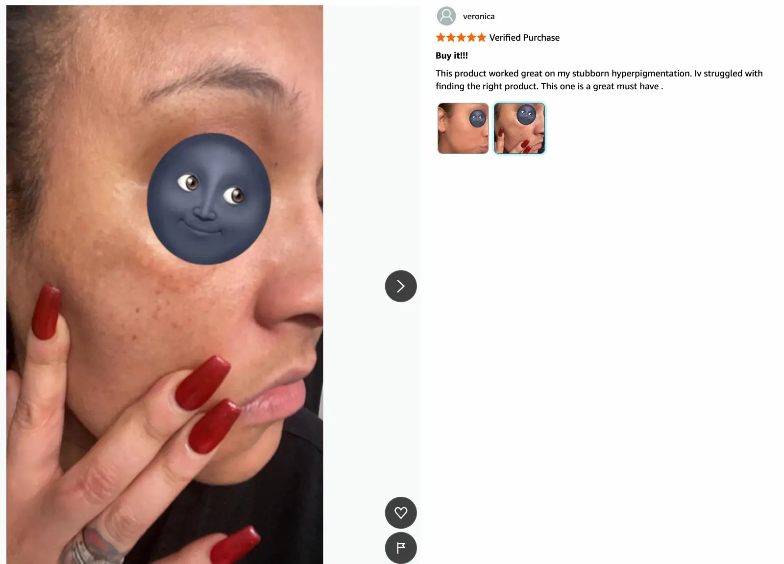 Customer review showing improvement in hyperpigmentation after using AMVital Turmeric Soap — smoother, brighter skin with reduced dark spots.